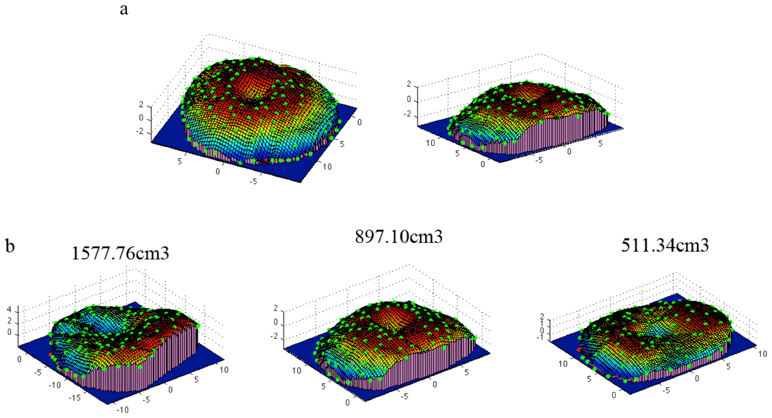 3D Surface Scanner